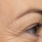 Close up of crow's feet and fine lines around the eye.