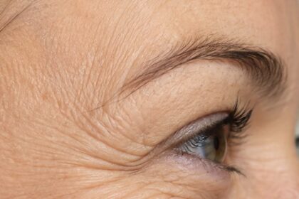 Close up of crow's feet and fine lines around the eye.